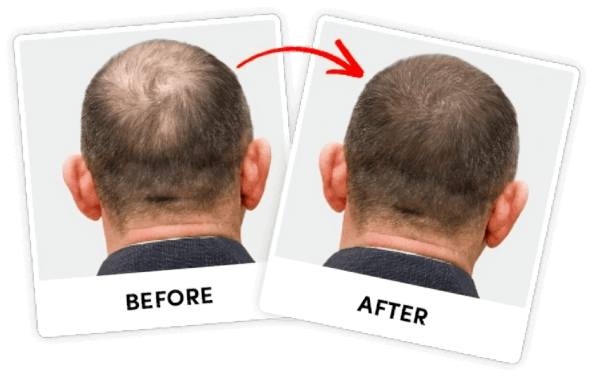 Restolin customer - Robert k,  ~FL, USA